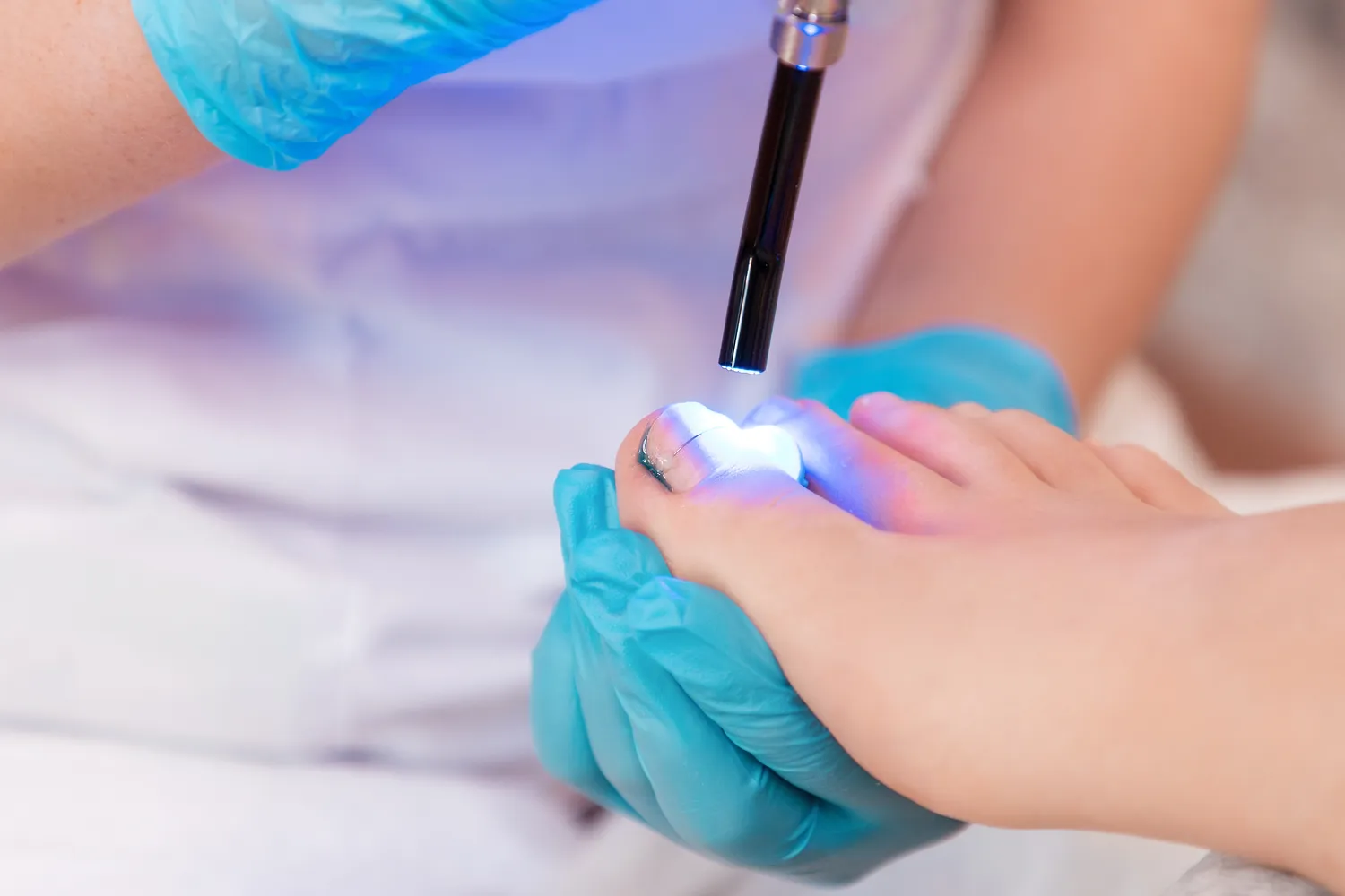 Pedicure leczniczy - co na ten temat wiedzieć trzeba?