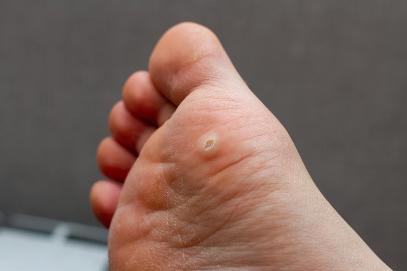 Pedicure podologiczne Szczecin