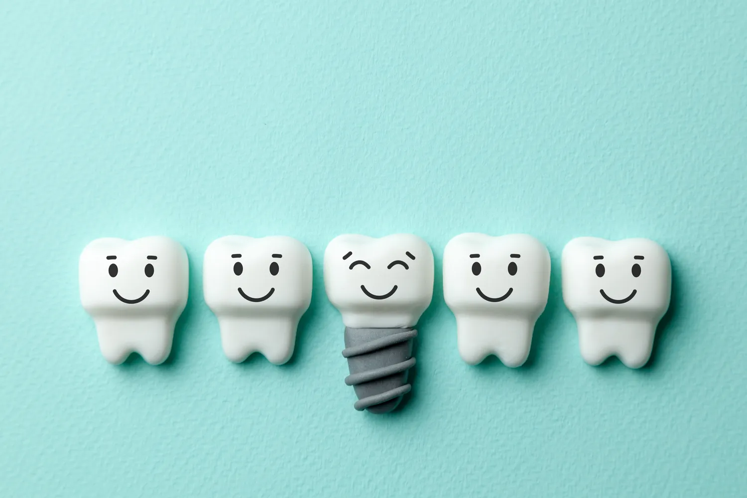 Bezśrubowe implanty co to znaczy?